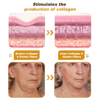 Botox Bee Venom Cream