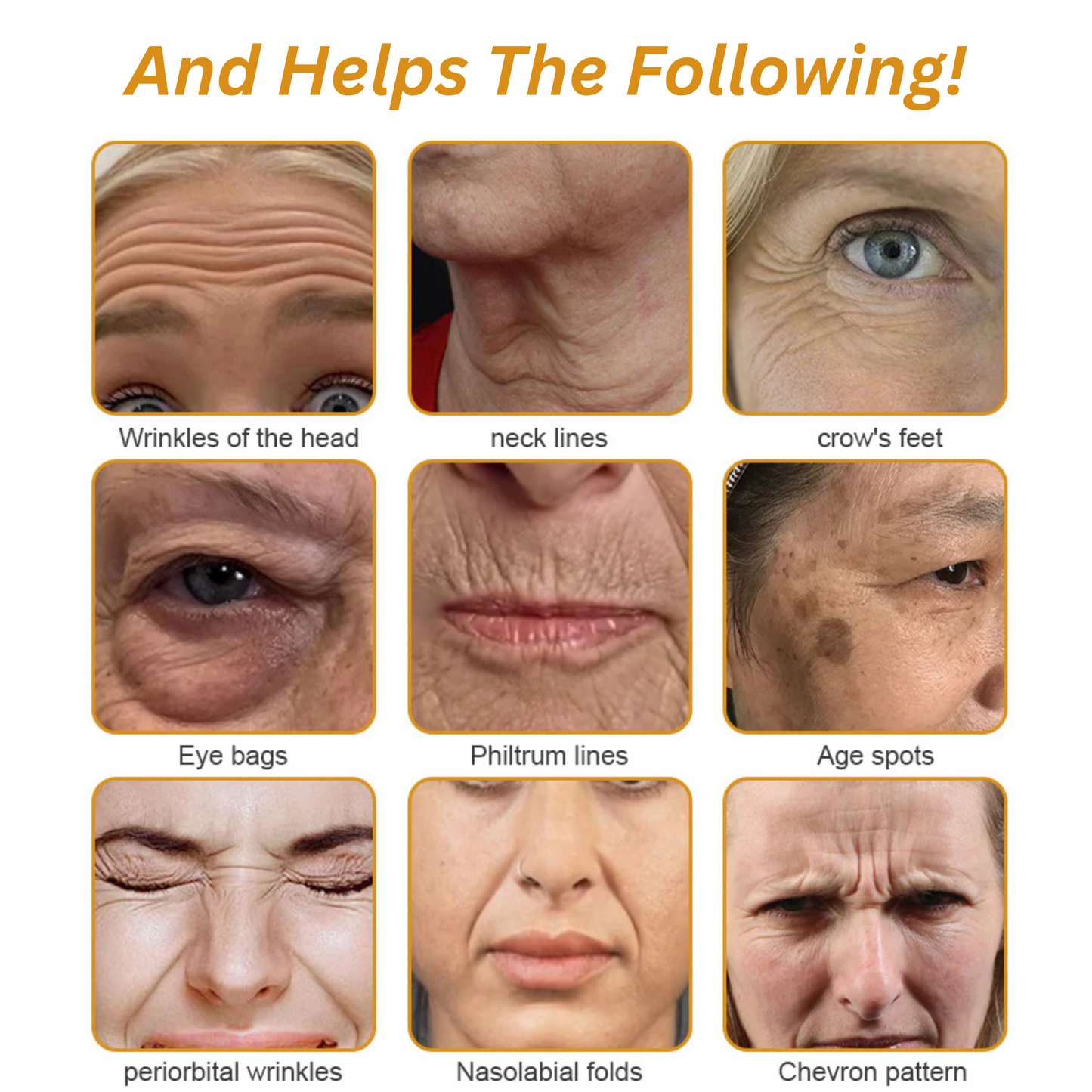 Botox Bee Venom Cream